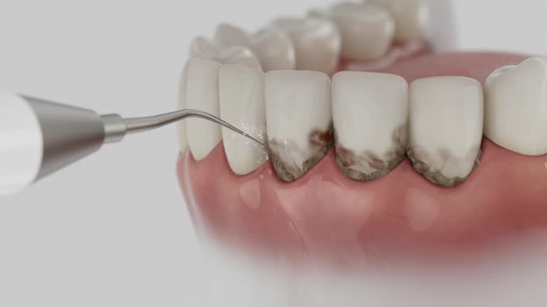 Trusted Dental Implants service in Prairieville, LA - Dentist Open Now